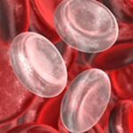 anemia microcítica hipocrómica