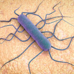 Listeria monocytogenes causa listeriosis