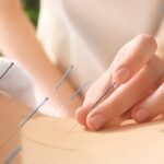Beneficios reales de la acupuntura para la salud