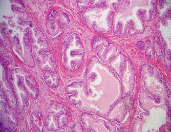 Histología de la Próstata