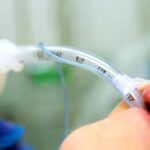 Complicaciones de la intubación endotraqueal