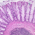 Capas de la pared del intestino grueso