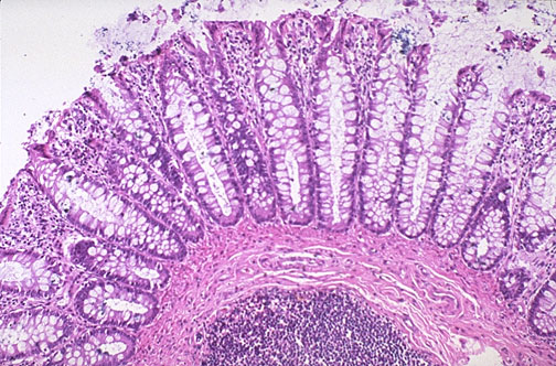 Capas de la pared del intestino grueso