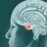 Tumores selares y supraselares