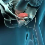 Anatomía externa de la próstata