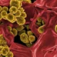 Infecciones por estafilococos