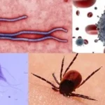 Diferencia entre infección e infestación