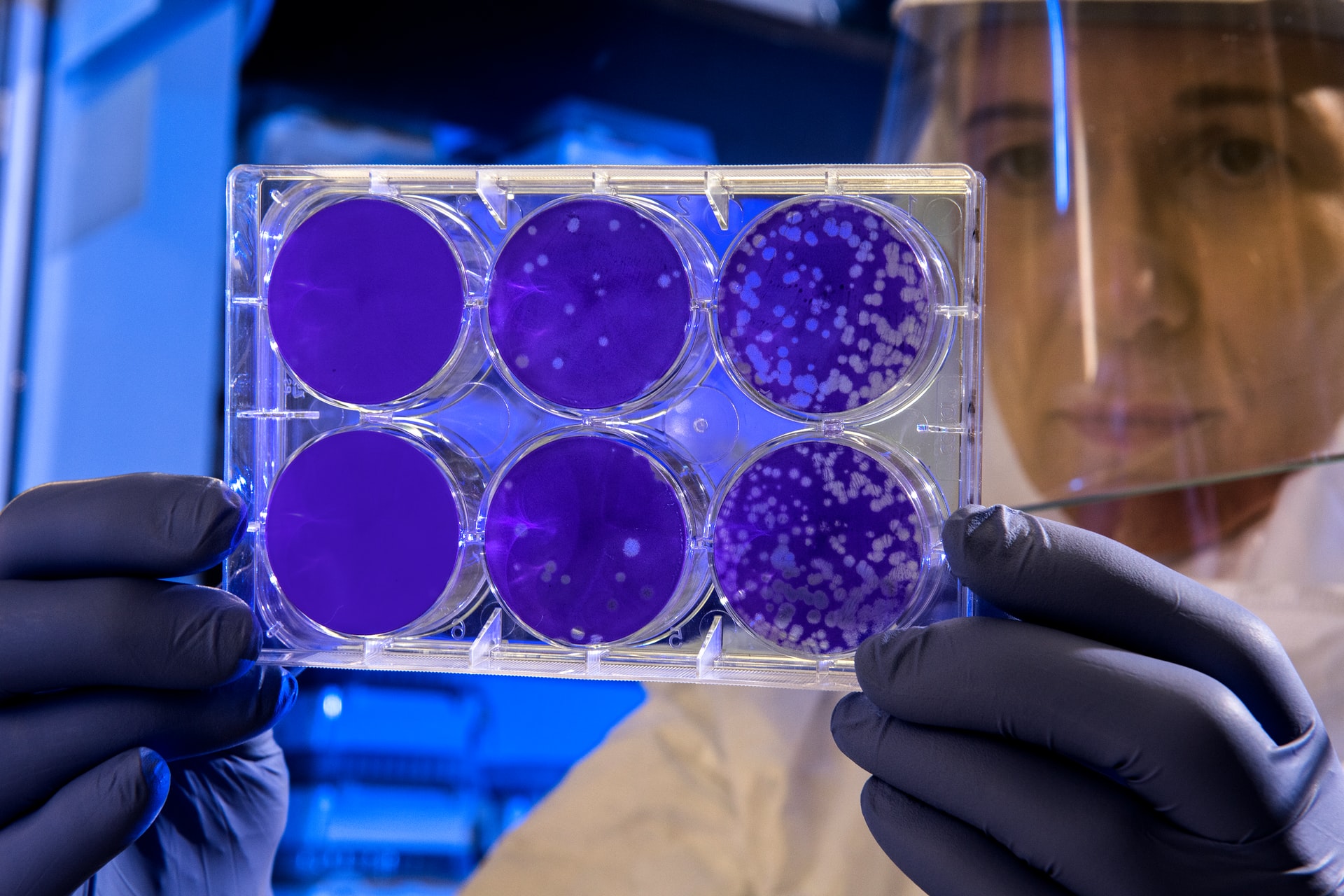 Transplante de células madre pluripotenciales inducidas