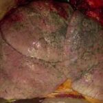 ¿Qué color tienen los pulmones?