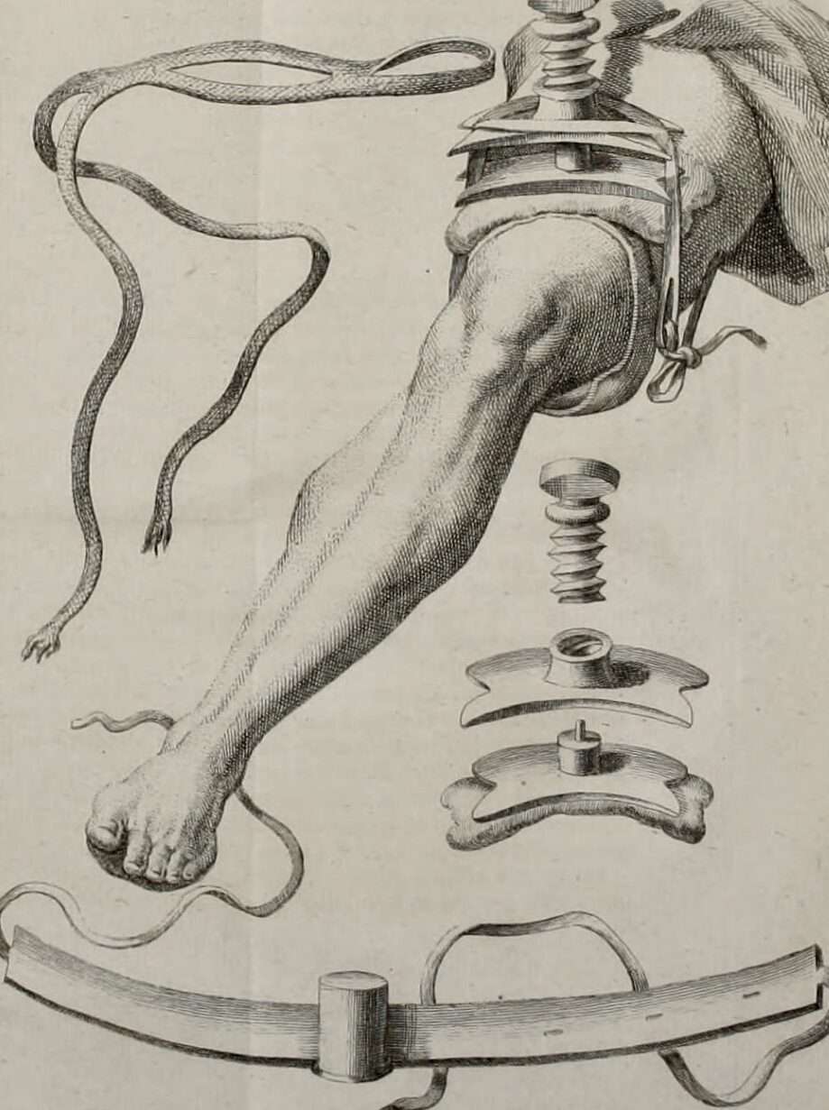 ¿Quién inventó el torniquete?