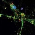 ¿Qué es una trampa extracelular de neutrófilos?