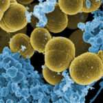 Versatilidad del Staphylococcus aureus