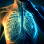 Diagnóstico diferencial de la infección del tracto respiratorio inferior