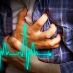 Terapia fibrinolítica en infarto con elevación de ST