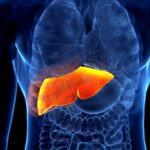 ¿Cuáles son las causas de hepatitis crónica?