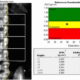 ¿Cuál es la utilidad de la absorciometría de rayos X dual?
