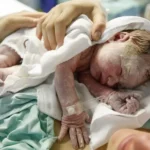 Efectos adversos fetales asociados con colestasis del embarazo