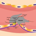 Tipos de enfermedad de von Willebrand