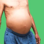 ¿Qué es la ascitis maligna?