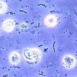 Tratamiento general de la bacteriuria asintomática