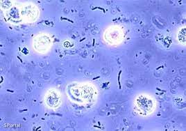 Tratamiento general de la bacteriuria asintomática