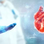 Manejo preoperatorio de pacientes con revascularización coronaria