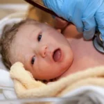 Características fisiológicas que distinguen al recién nacido