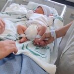 Hipoglucemia en el recién nacido