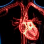 Miocarditis no infecciosa