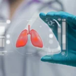 Factores de riesgo para complicaciones pulmonares en el postoperatorio