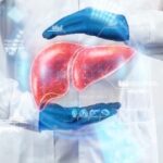 Evaluación preoperatoria de pacientes con enfermedad hepática