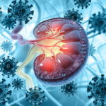 Nefropatía asociada al virus de la inmunodeficiencia humana