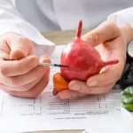 Tratamiento de la incontinencia urinaria por rebosamiento