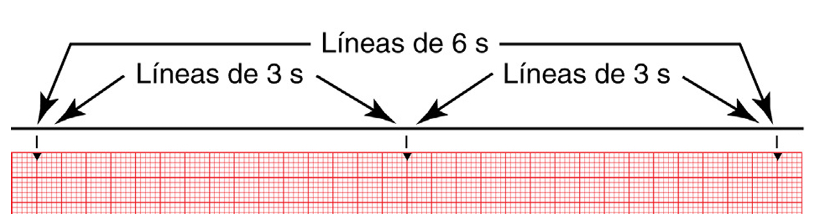 ¿Cuáles son las líneas de tiempo del electrocardiograma?