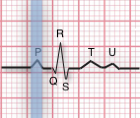 ¿Qué representa la onda P del electrocardiograma?