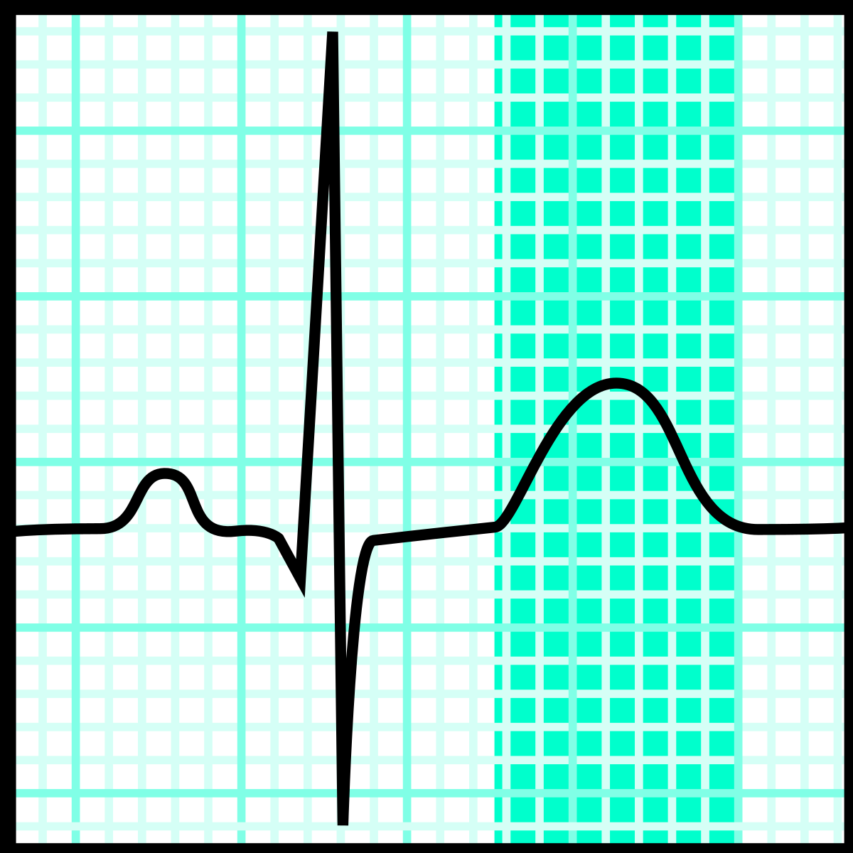 ¿Qué representa la onda T del electrocardiograma?