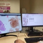 La patología cubre todos los aspectos de la enfermedad