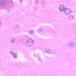 Las proteínas del estrés son citoprotectoras