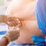 Administración epidural de fármacos para el dolor