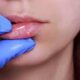 Tratamiento sistémico contra la infección por herpes simple
