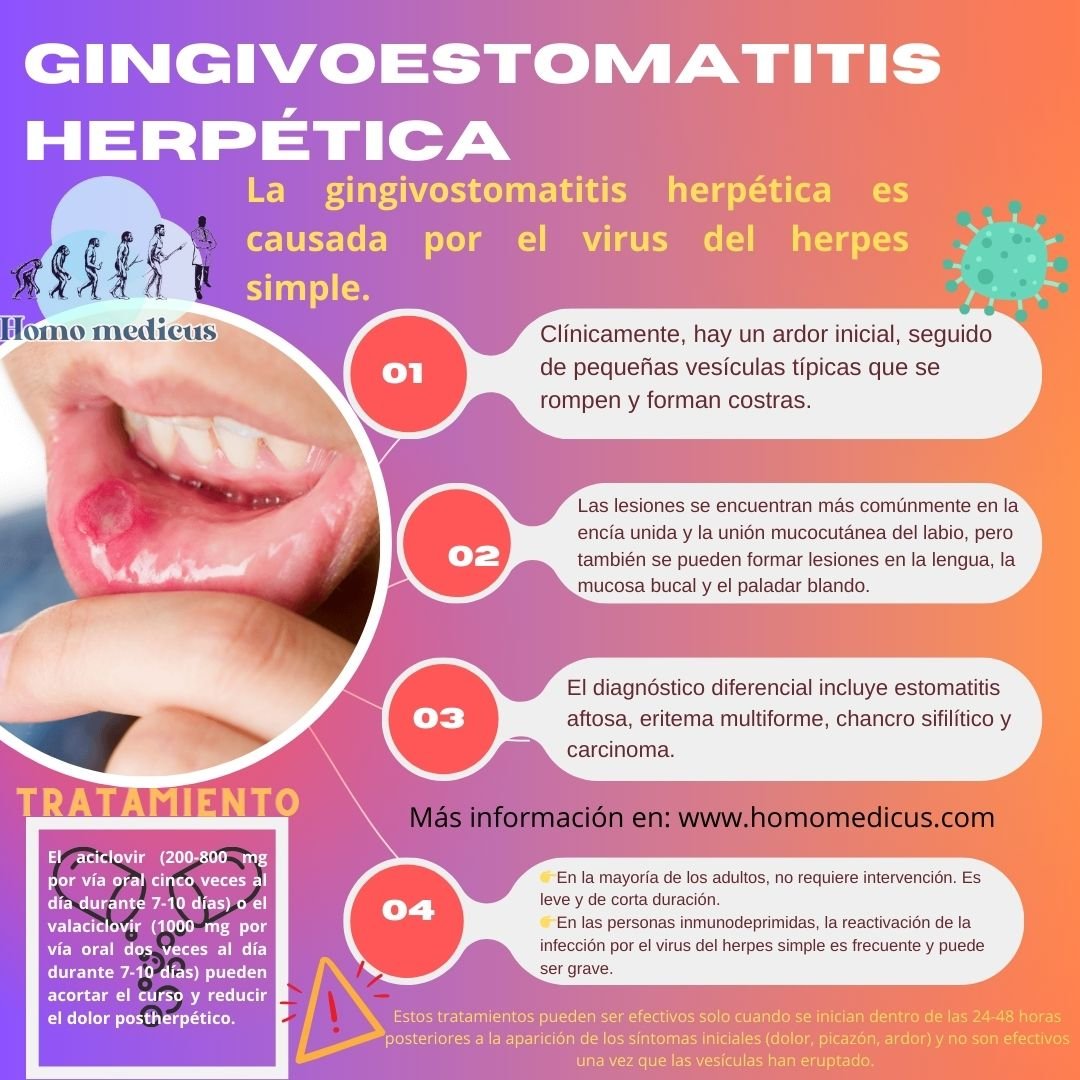 Gingivoestomatitis Herp tica Homo Medicus