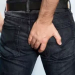 Prurito anogenital