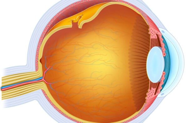 Desprendimiento de retina
