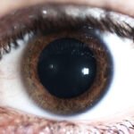 La dilatación de la pupila puede precipitar glaucoma