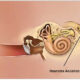 Schwannoma Vestibular (Neuroma Acústico)