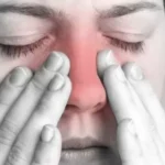 Clasificación de la rinosinusitis