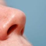 Vestibulitis nasal y colonización nasal de S aureus
