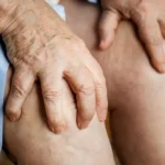 ¿Cuál es la causa de la artritis reumatoide?