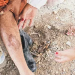 ¿Qué transmite la leishmaniasis?