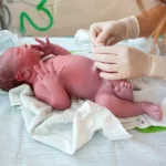 ¿Cómo se obtiene la puntuación de Apgar?